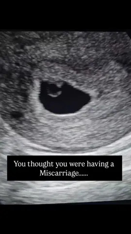 Sometimes, you're just too early. Has this ever happened to you? #ultrasound #pregnancy #firsttrimester #miscarriage 