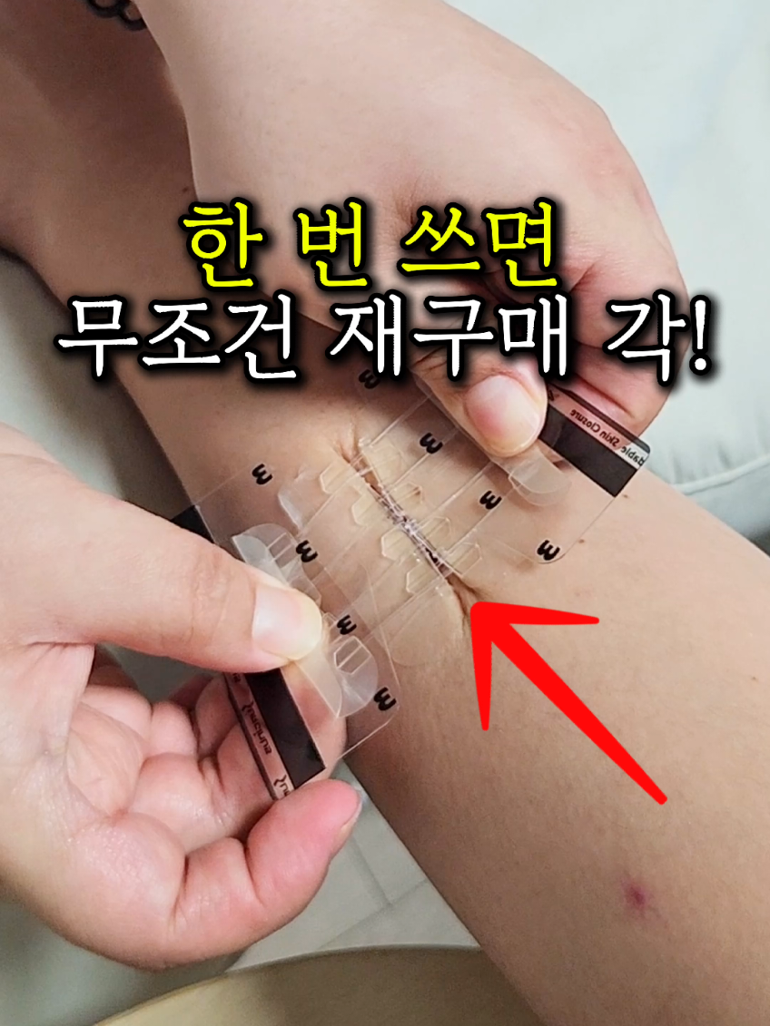 한번 쓰면 무조건 재구매 각🫢 ⭐️제품 정보는⭐️ @sallim_friend 제 프로필사진 클릭 후 보이는 링크 클릭‼️ [152. 봉합밴드] [153. 끈끈이 면봉] [50. 방수겔밴드] #살림꿀템 #꿀템 #쿠팡꿀템 #쿠팡추천템 #살림스타그램