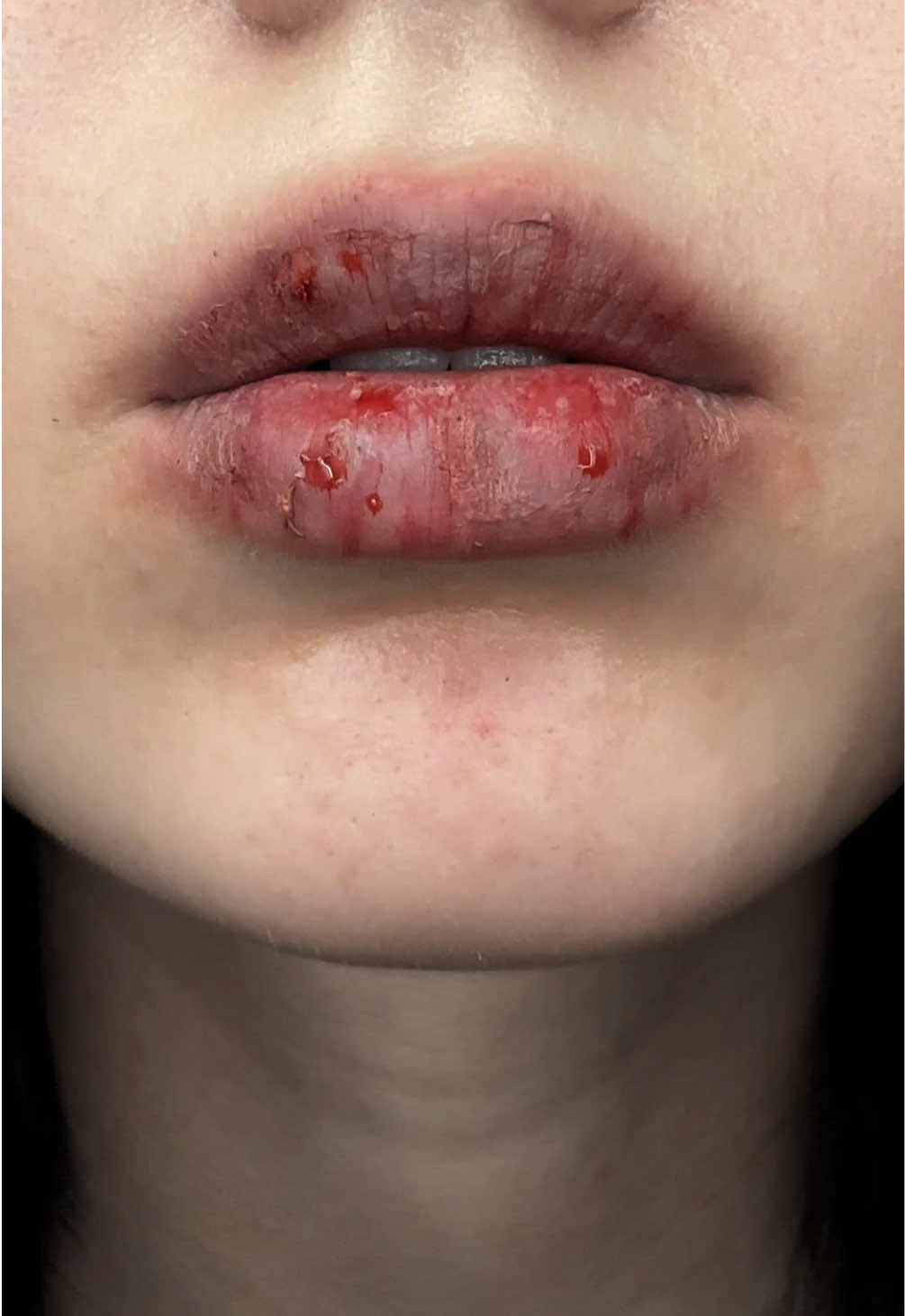 dead lips >> #makeup 