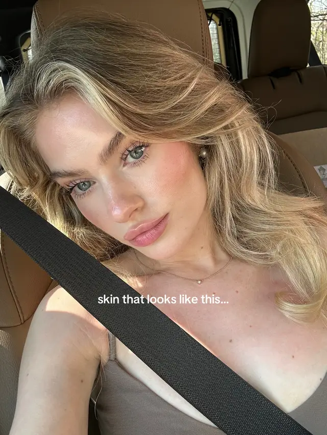 i used to cry everytime my skin would break out like in these photos. Now i don’t cry i just get annoyed for a second and move on because it’s NOT WORTH THE TEARS. we all go through it and im not gonna lie and say im happy with it. it IS annoying and painful and irritating but it’s all part of being human & i can PROMISE you it doesn’t take away from your beauty not even one bit. I can only hope that this makes one of you feel less alone ❤️ #acne #skin #hormonalacne 