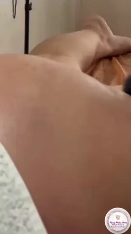 ✨ La Vacumterapia es un tratamiento estético que utiliza succión controlada para estimular el tejido subcutáneo. Más allá de la reducción de medidas que ves en el video, este procedimiento también: 🔹 Mejora la circulación sanguínea y linfática, ayudando al cuerpo a eliminar toxinas de forma natural. 🔹 Favorece la oxigenación de la piel, lo que mejora su elasticidad y firmeza. 🔹 Previene y trata la celulitis, ya que rompe los depósitos grasos y estimula la producción de colágeno. 🔹 No es invasivo ni doloroso, lo que lo convierte en una alternativa segura y relajante. 💡 Se recomienda combinar la vacumterapia con hábitos saludables (alimentación balanceada y actividad física) para potenciar y mantener los resultados. 👉 Reserva tu sesión y comienza a ver los cambios en tu piel y figura.