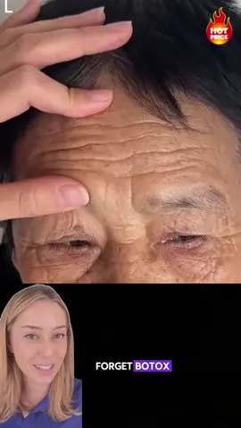 Mujeres de 25 años o más, iatención! Si te preocupan las líneas de la sonrisa, las arrugas en los ojos o en el cuello, este sérum, rico en ginsenósidos, te mostrará resultados visibles en solo 21 días.