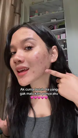 Soalny cantik #vinacuu12 