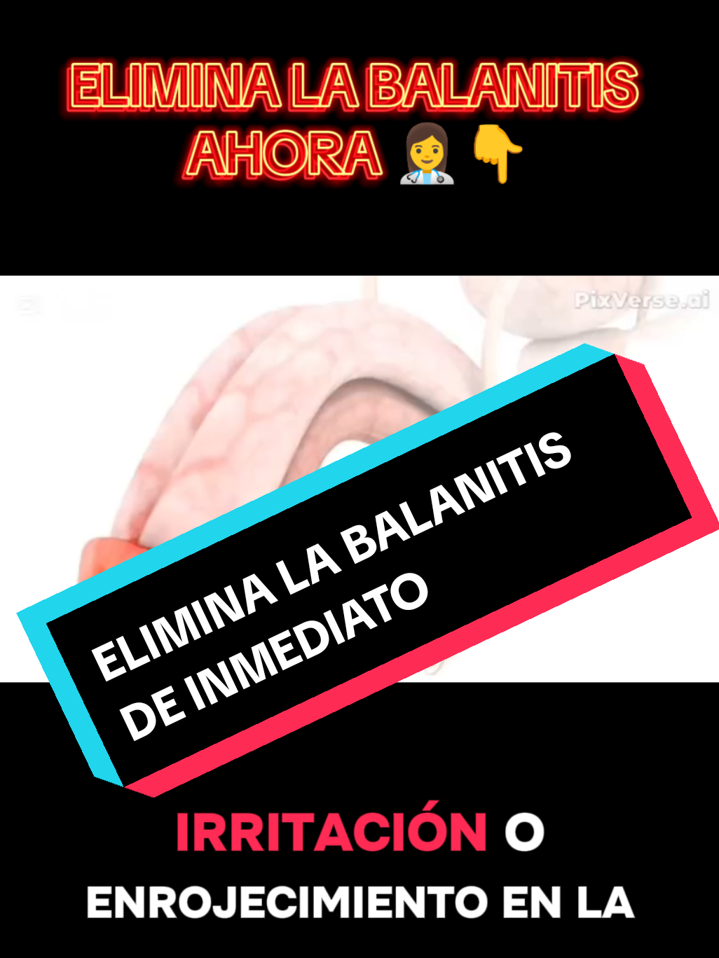 BALANITIS, GRANITOS O PICAZON NO MAS  CONTACTAME AHORA 👉👩‍⚕️ #its #latinosenusa #healthylifestyle #men #saludintima 