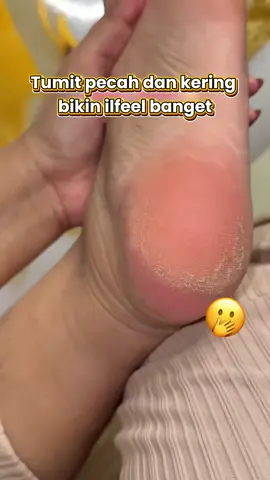 Tumit pecah & kering bikin ilfeel? 😖   Cukup pakai Lanbena Foot Peel Mask, kulit mati terangkat dan kaki jadi lembab & halus ✨ #FootPeelMask #ByeTumitKering #KakiHalusMulus #PerawatanKaki #lanbena 