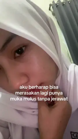 semogaa yaa🥹🥹#shalubeauty #jerawat #sembuhdarijerawat #jerawathilang #jerawatan 