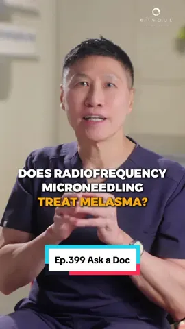 Melasma: Treating Beyond the Surface Melasma isn’t just surface pigmentation — it’s a chronic skin disorder influenced by vascular activity, basement membrane weakness, and persistent inflammation. Radiofrequency Microneedling (RF Microneedling) addresses these underlying mechanisms by: - Calming overactive blood vessels that drive pigment production - Repairing and reinforcing the basement membrane between skin layers - Reducing inflammation that keeps melasma active While RF Microneedling helps manage the root triggers, it is most effective when combined with laser treatments to clear existing pigment for a more even complexion. In this video, Dr. Thean explains how RF Microneedling strengthens skin from within, making melasma management safer and more effective. #microneedling #pigmentation #ensoulclinic #melasma #tiktoksg Tel: +65 6836 2833 Whatsapp: +65 8798 2892 Email: info@ensoulclinic.com For more information, visit www.ensoulclinic.com
