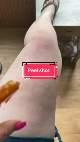 Dr Melaxin gave us a body peel shot with turmeric and kojic acid to brighten our skin #drmelaxin #bodypeelshot #drmelaxinbodypeelshot #TikTokShopRestock #TikTokShopCreatorPicks 