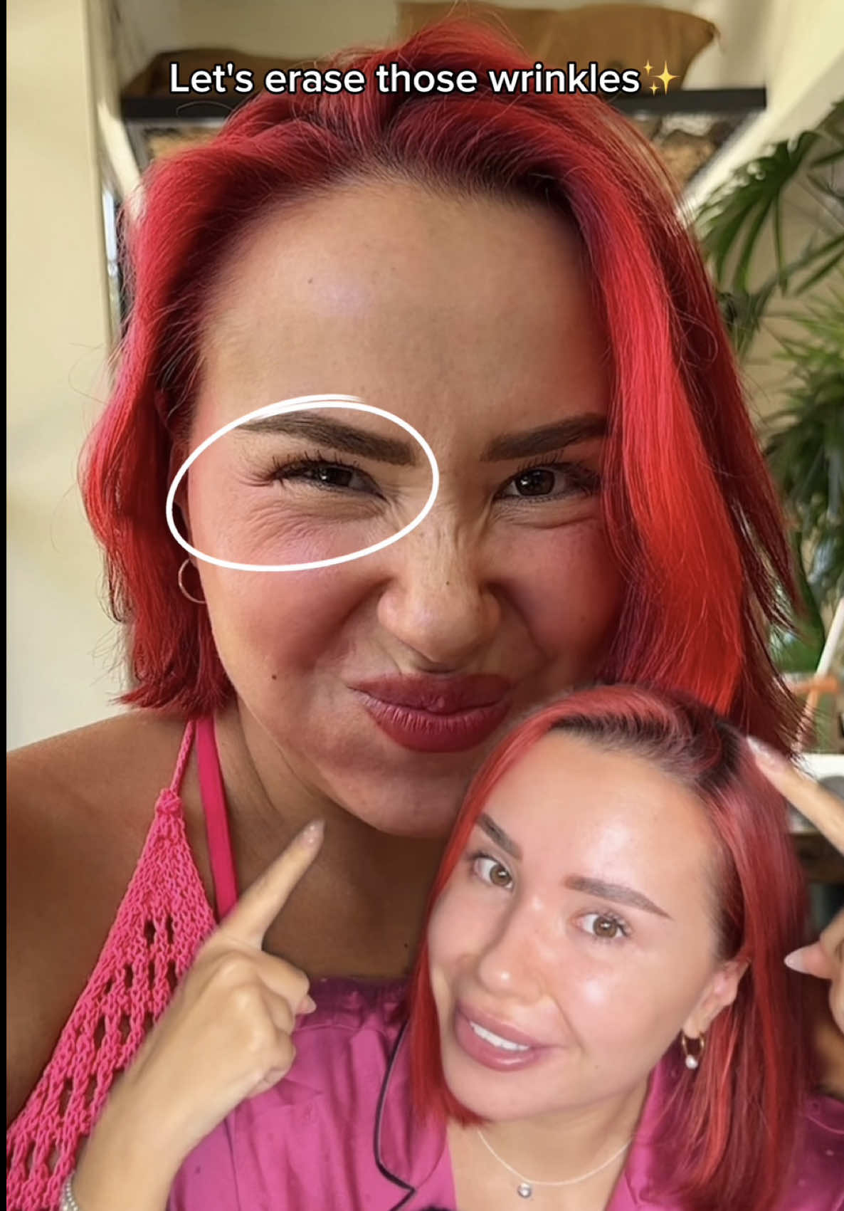 Want to achieve glass skin in just 8 days?😍 Here’s my new skincare routine!🔥 . #8days #glassskin #skincareroutine #healthyskin #amazonfinds