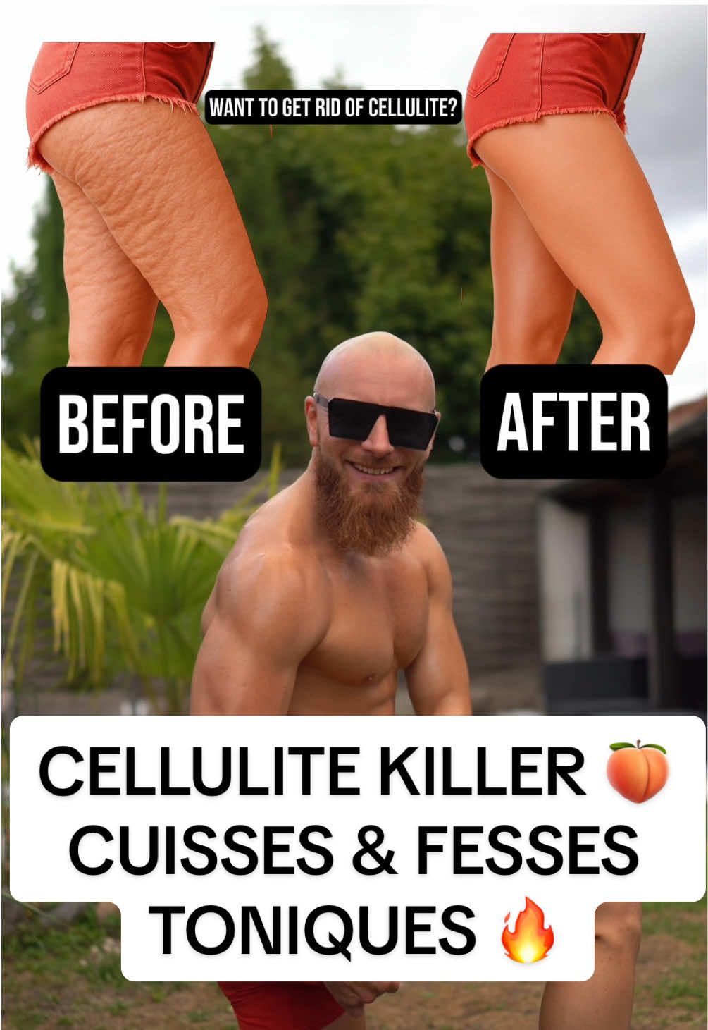 CELLULITE KILLER 🍑 CUISSES & FESSES TONIQUES 🔥 ENREGISTRE • LIKE • COMMENTE • PARTAGE Objectif ⬇️ Réduire l’apparence de la cellulite en ciblant l’arrière des cuisses, activer la circulation et tonifier pour un rendu ferme et lisse. Marre de la cellulite derrière les cuisses ? Voici la séance ultime pour raffermir, galber et lisser tes jambes. Séance complète ⬇️ • 6 exercices ciblés • 4 séries par exercice • 15 répétitions par série • 30 secondes de récupération entre chaque série • 1 minute entre les exercices 🔑 Contraction volontaire + exécution contrôlée = la clé pour transformer tes cuisses. Et toi, tu as de la cellulite aux cuisses ? 👇🏼 ⸻ #mericcoach #cellulitekiller #arrieredescuisses #cuissesfermes #cuissesgalbées                         