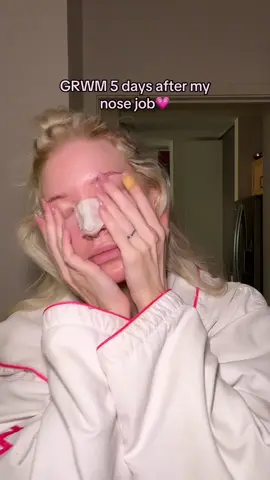 So ready for Thursday #postop #nosejob #grwm #girls #relatable 