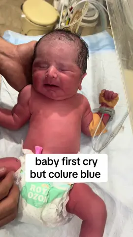 baby first cry no reasponse #colure blue #newbornbaby #unfreezemyacount 