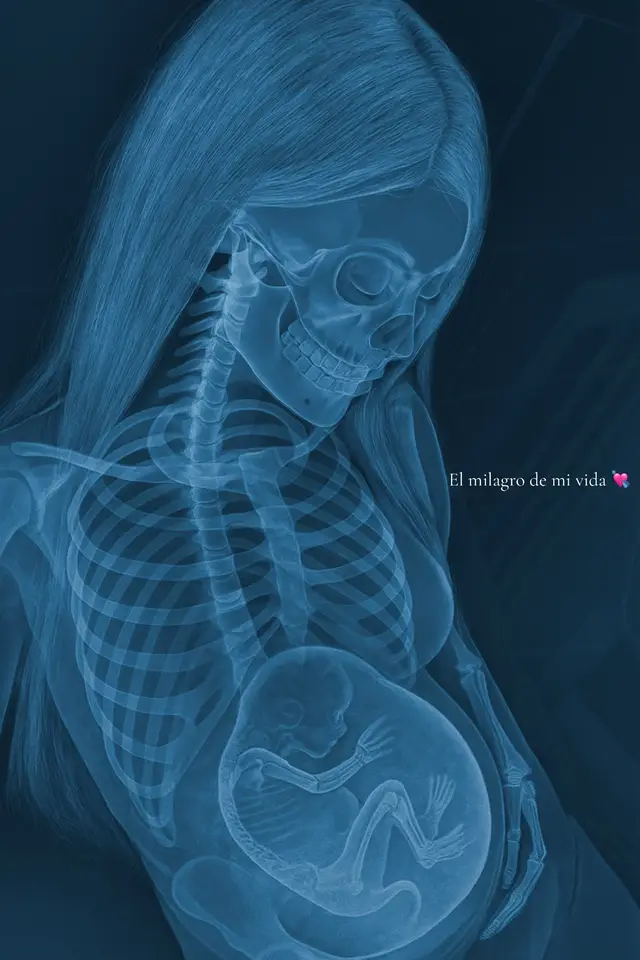 mi amor puro y verdadero.. 💞 #pregnancy #paratiiiiiiiiiiiiiiiiiiiiiiiiiiiiiii #fyp #babygirl 