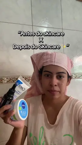 “Skincare também transforma 💖 #antesedepois#skincarebrasil#cuidadoscomapele#peleperfeita#skincareroutines 