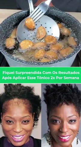 Muitos ignoram essa poderosa receita caseira #crescimentocapilar #cabeloslongos #cabelocacheado #cabelocurto 