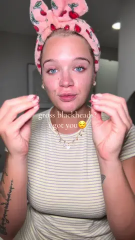 an instant blackhead remover?? yes please🥹😍 #blackheads #pores #skincare #clearskin #salicylicacid 