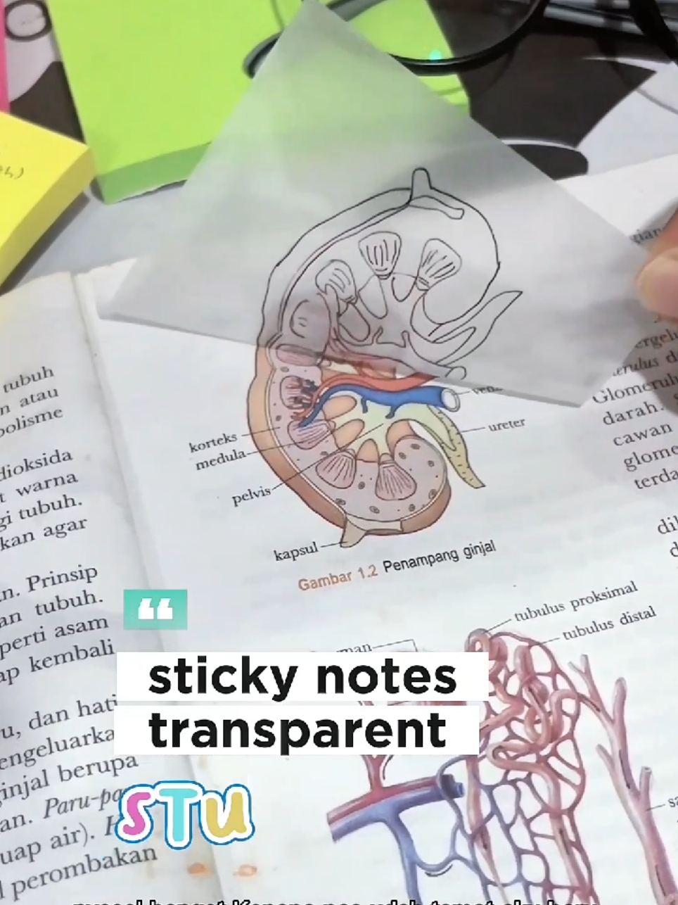 sticky notes transparan tips buat anak sekolahan #fyp #fypage #studyhack #belajar #sekolah #anaksekolah #stickynotes #stickynotetransparan #tipsbelajar 