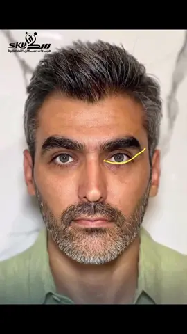 💉 ✨ فيلر بعرض لمده محدوده… وتجميل الانف لجمال أكثر! ✨ 💉 احصلي على شفاه ممتلئة، خدود مرفوعة،  وبشرة مشدودة بأفضل أنواع الفيلر العالمية،  بأسعار لن تتكرر وحصريه !  😍🔥💎 ملامح متناسقة وجاذبية طبيعية✨  نتائج فورية بدون جراحة💖  لمسة ناعمة تدوم طويلاًجمالك بين يديكِ…  لا تترددي!  احجزي الآن واستمتعي بإطلالة ساحرة! 💋 📞 للاستفسار والحجز:📍: 01010878708 -  #filler #fillercheck #فيلر #tentcreatorinsights #contentcreatorinsightsearch #contentcreatorinsights 