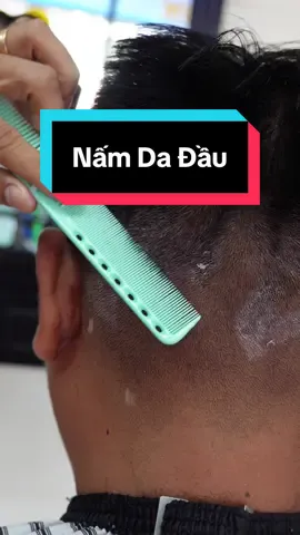 Anh em tin tui, bị nấm da đầu , bị gàu ngứa hay bị v.iêm da tiết bã thì cứ snowclear one mà quất là oke ngày#nguadadau #namdadau #snowclearone 