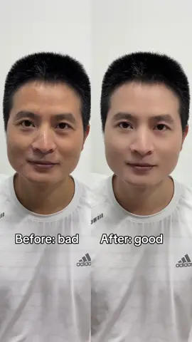 BEST upgrade. No one noticed I had anything on. #mensgrooming #skintintformen #nomakeupmakeup #BeforeAndAfter #tiktokmademebuyit