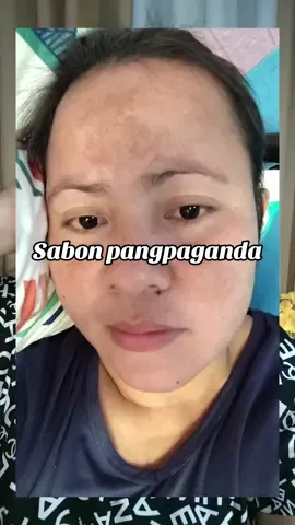 #melasmatreatment #melasmaskincare #melasmaremover #suhadaphilippines #melasma 