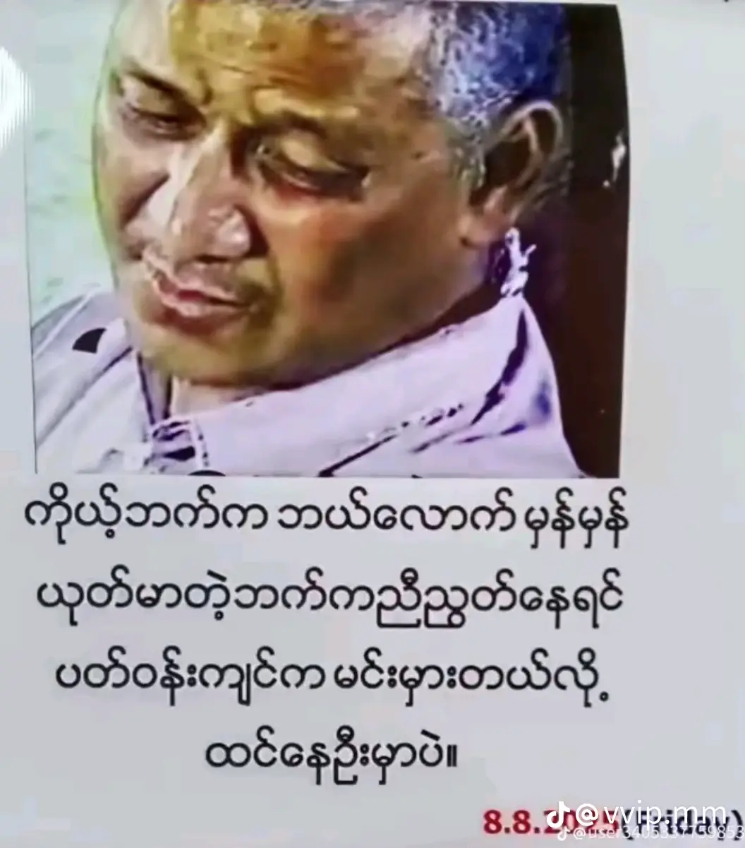 #လူတွေလူတွေ🙂🙃 #yadanaraunghtet1 #fyppppppppppppppppppppppp #foryou #မဖလုတ်နဲ့ကွာ☹ 