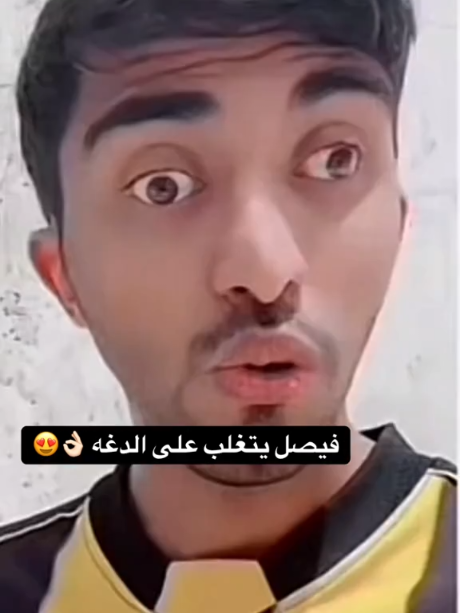 فيصغ تغلب ع الدغة 🤩 #فيصل_ابراهيم  #فيصغ  #ترند #سعوديه #💔 