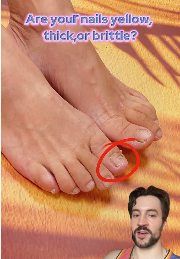 “Still dealing with recurring nail issues? Stop wasting time!”#laborday #laborday2025 #happylaborday #trend #spotlightfinds  