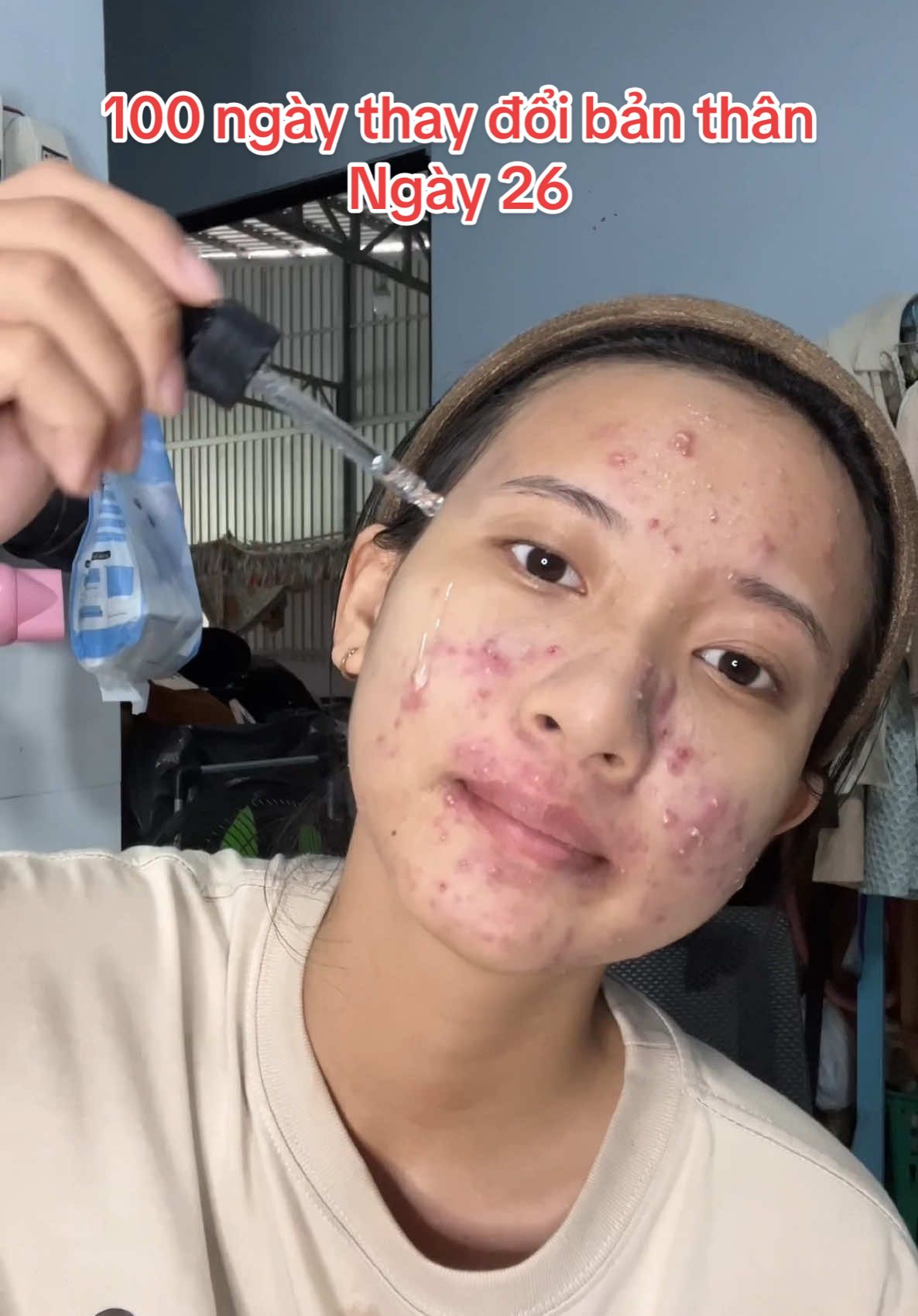 Day 26: skincare #xuhuong #100ngaythaydoibanthan #mun #skincare 