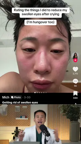 How to get rid of puffy swollen eyelids with hot or cold compresses. Morning swelling or allergies? Styes? #swolleneye #puffyeyes #puffyface #stye #eyelids 