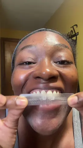The holy grail of whitening strips! Made with coconut oil, it’s perfect for sensitive teeth but still very effective! Stays In place for up to 3 hours so you can still drink, talk, even exercise! Grab yours now! #whiteningstrips #gurunanda #whiteteethchallenge #sensitiveteeth #whiteteeth 