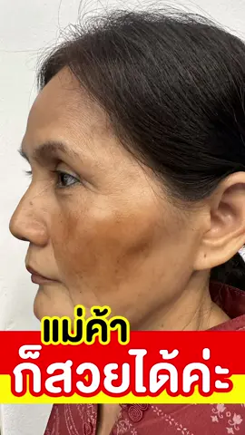 #ครีมฝ้ากิมจิ #ครีมกิมจิ #ครีมทาฝ้ากิมจิ #kimchicream #รีวิวบิวตี้ 