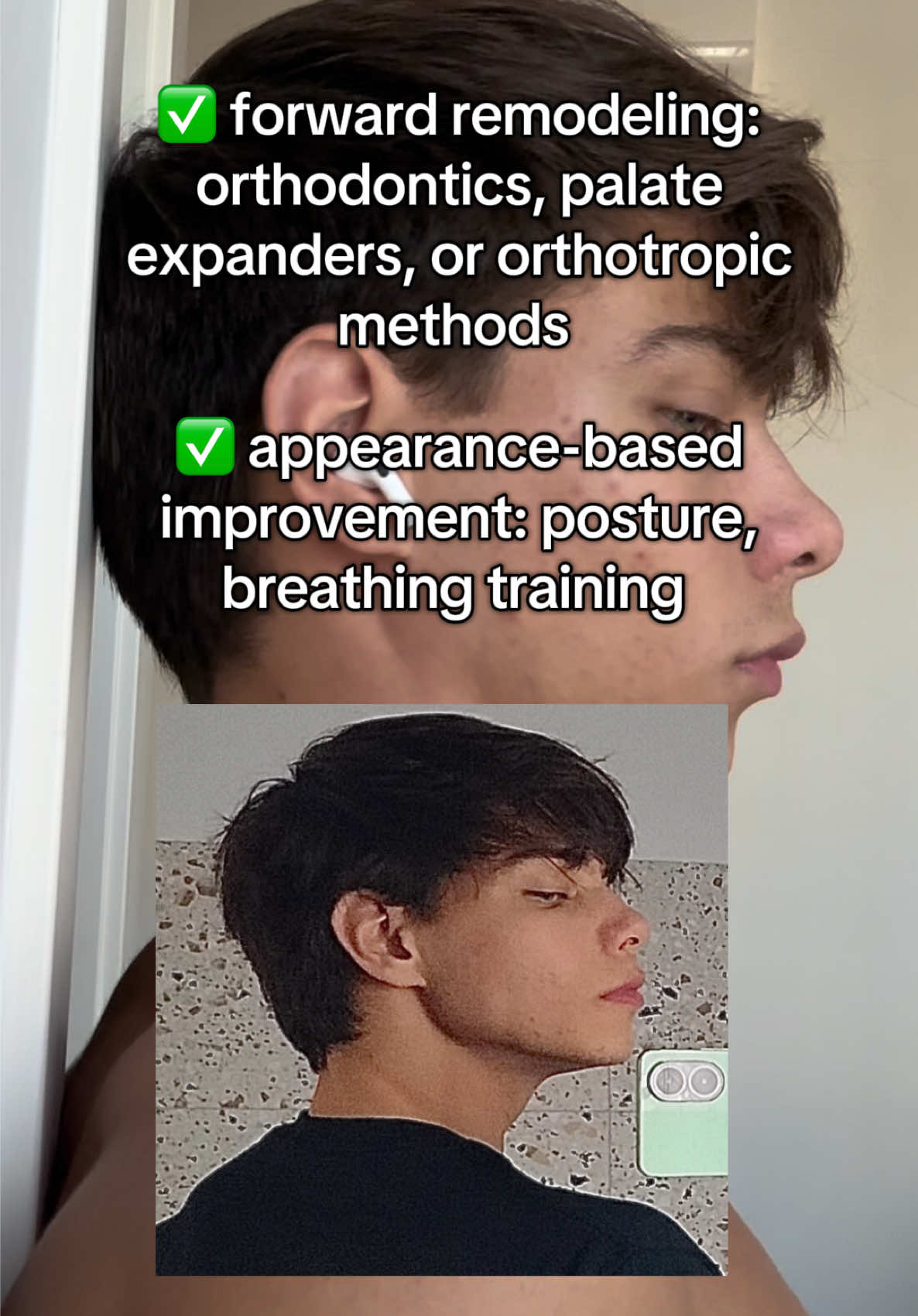 how to get forward growth #jawline #sideprofile #mogged 