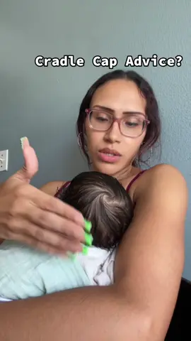 I just don’t want it to cause too much balding. #MomsofTikTok #momlife #momtok #momadvice #cradlecap 