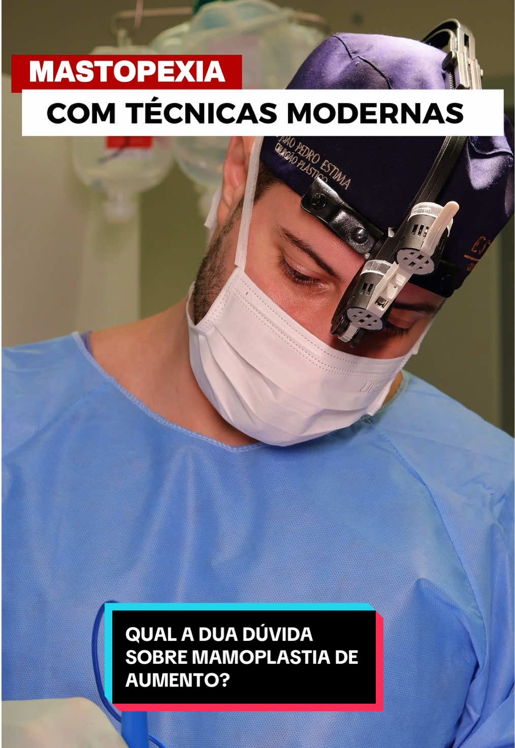 QUAL A DUA DÚVIDA SOBRE MAMOPLASTIA DE AUMENTO? Deixe nos comentários que eu vou te responder. ❗️Ainda existem muitas dúvidas e informações distorcidas sobre o silicone, e isso pode fazer muita gente adiar ou até desistir de realizar o sonho do aumento das mamas. ✅ Por isso, preparei este conteúdo para esclarecer os principais mitos e verdades sobre a mamoplastia de aumento, baseado na prática clínica, em técnicas atualizadas e na segurança que sempre priorizamos. 🔍 Tecnologia e segurança que utilizamos: Aqui, cada cirurgia é planejada de forma personalizada, avaliando biotipo, medidas e desejo da paciente. Utilizamos: • Planejamento 3D para prever resultados • Próteses de alta qualidade, aprovadas pela Anvisa • Técnica do sutiã interno, que garante sustentação e durabilidade • Ambiente hospitalar e equipe treinada para total segurança 💬 Conclusão: Colocar silicone não é apenas sobre aumentar o tamanho das mamas, mas sobre harmonizar o corpo, melhorar a autoestima e valorizar a sua beleza natural. Conteúdo médico educativo Dr João Pedro Estima Médico Cirurgião Plástico CRM: 5293015-6 RQE: 33252 #drjoaopedroestima #cirurgiaplastica #cirurgiaplasticarj #protesedesilicone#mastopexiaa          