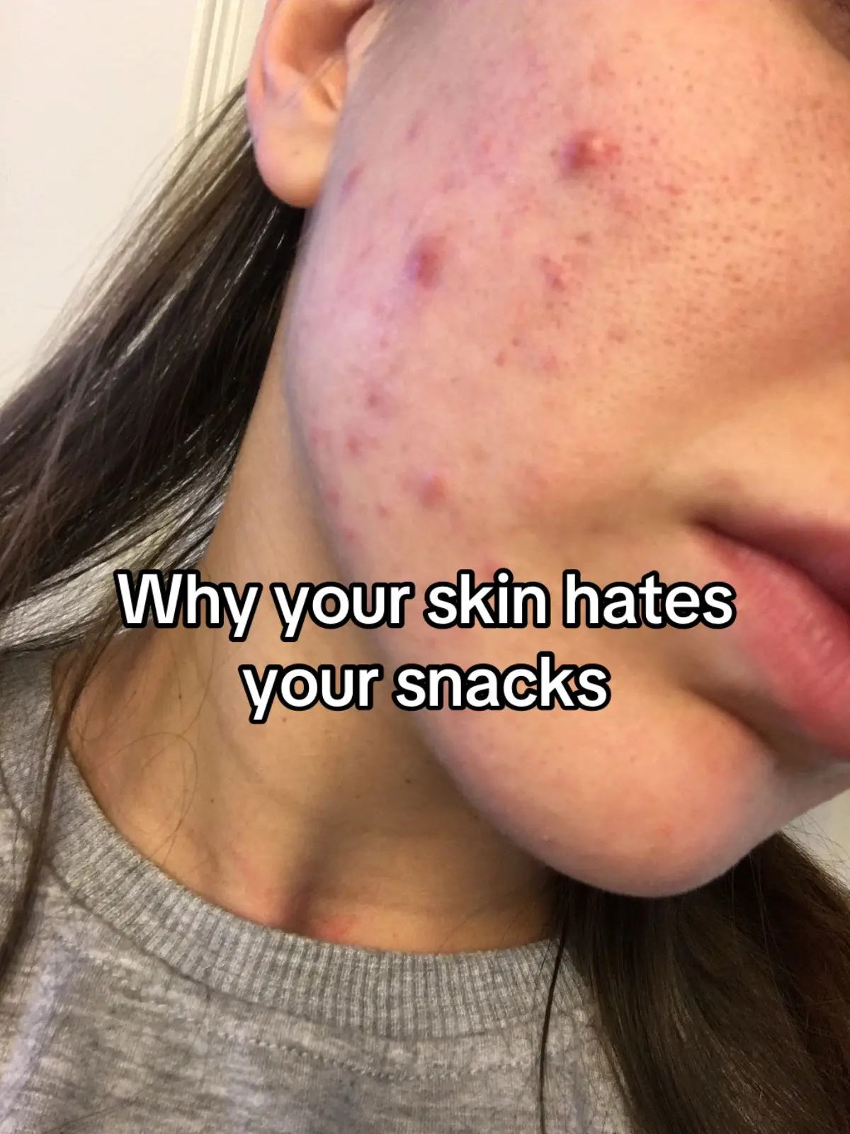 #skincare #skinglow #realfood