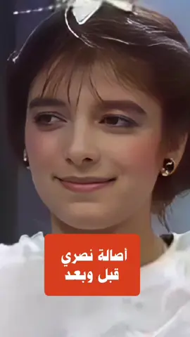 أصالة نصري قبل وبعد  #اصالة #أصالة #اصالة_نصري #فنانين #فنانين_العرب 