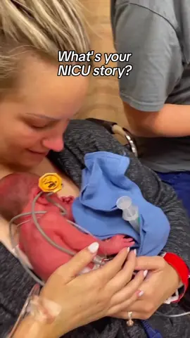 The NICU changes you. Whether you were there for days or months… whether you brought your baby home or carry their memory in your heart… your story matters. 💜 Not every NICU journey ends in celebration. Some end in unimaginable grief. But every single one is a testament to love, courage, and the strength it takes to show up for your baby—no matter what. Share a piece of your story in the comments. Let’s uplift, honor, and remember together NICUMoms #NICUAwareness
‌ Kayla Joy @‌swankydiary