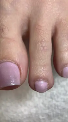 ✨ Pedicure Ruso ✨ Una técnica que transforma por completo tus pies 🌸. Con el uso de torno y herramientas de precisión, eliminamos toda la cutícula y piel muerta, logrando un acabado limpio, elegante y duradero 💅. Ideal para quienes buscan un resultado más estético y profesional. Realizado por Dayi ✨💖 #Nailschool #nailsperfect #acrylicnails #nailss #nailsvideos                 