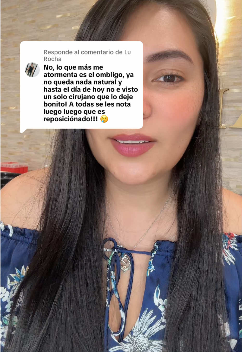 Respuesta a @Lu Rocha el ombligo de una abdominoplastia #tummytuckrecovery #tummytuckmiami #lipo360 #abdominoplastia #latinasenusa #plasticsurgeryusa #latinasenusa #colombianosennewyork #bblmiami #tummytuck #tuneadas 