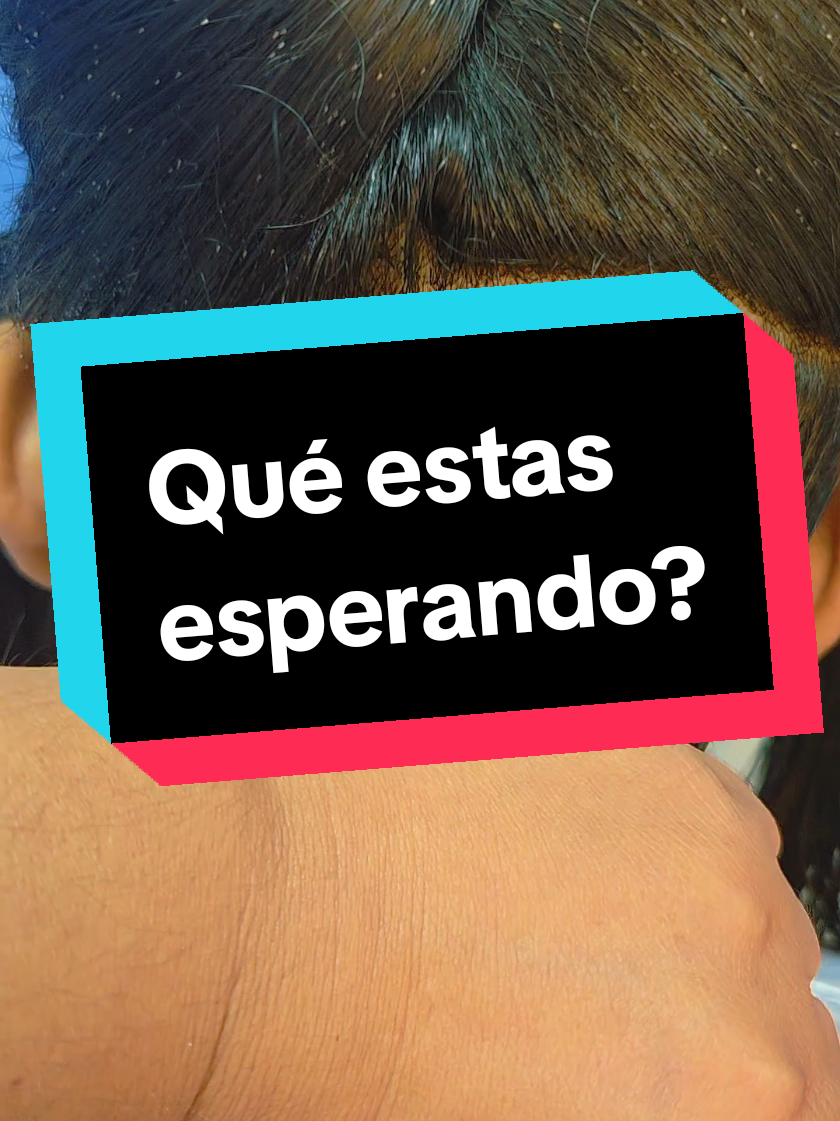 Finalmente, es tu decisión 🫵 #piojos #productoscaseros #help #mipelo #peru 