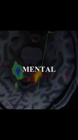 Why Your Brain Feels Tired Before the Day Even Starts #fyp #psychology #neuroscience #SelfImprovement #mindset 