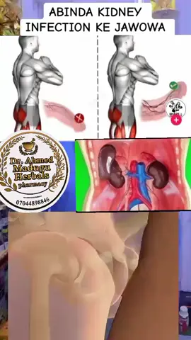 #creatorsearchinsights #foryou #garlic #nigeria #foryoupage @Almaleek Harbals And islamic @Dr sultan backup✅ @ISLAMIC_HERBALS_MEDICINE @Dr Ismail Aminu 02 @almaleek herbal company (3) @Dr Sultan Islamic medicine @dr deeni  Herbs 🌿 @Staff Sultan Herbs @Almaleek_Herbal_Medicine_Kduna @dr Khaleepha Herbal 