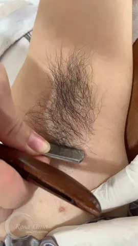 Lông nách cạo đã cái tay🤣 #trietlongnach  #trietlong #trietlongtrieukhuc #trietlongvinhvien  #trietnach 