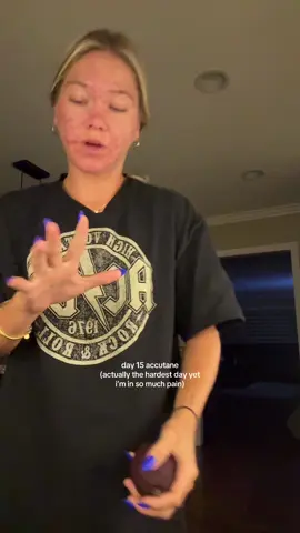 loud jazz music bc u don’t need to hear me cry. another one i wasnt gonna post but so many of u have reached out to me saying when i share the lows, it makes u feel less alone. so this is for u!!! ur not alone😖 #accutane 