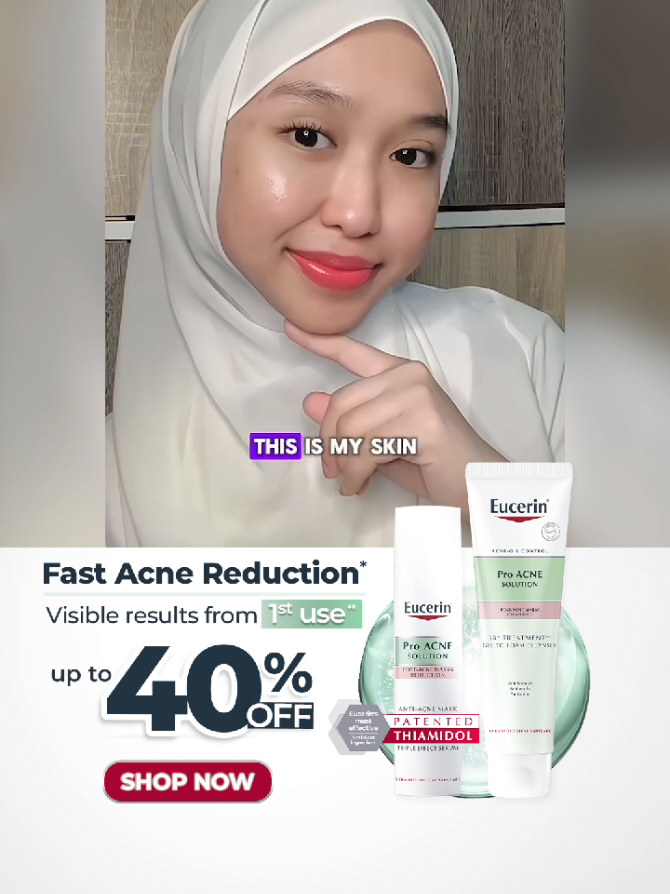 First use terus nampak beza? 👀 Tak sangka seawal sekali guna je, kulit terus nampak lebih bersih & sihat 😍 Memang jadi penyelamat utama saya bila breakout! #EucerinMY #EucerinAcneExpert #Dermatologicalskincar #EucerinProAcne #M1 
