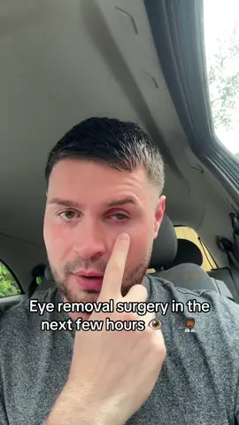 I have had Phthisis bulbi after a knife injury to the eye ball 7 years ago, after years of being in pain, sensitivity to sunlight, physically draining I have finally got the the date of my surgery to have it removed, anyone interested in joining in on the process feel free to drop me a follow #eyeremoval #surgery #surgerytiktok #injury 
