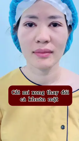 #sửamí #cắtmí #xuhuong #Mochuong #mộchươngbeautycenter 