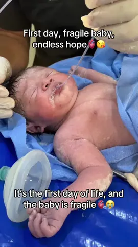 #trandingsund #mydream10millionviews #nicubaby #usa🇺🇸 #weakbaby 