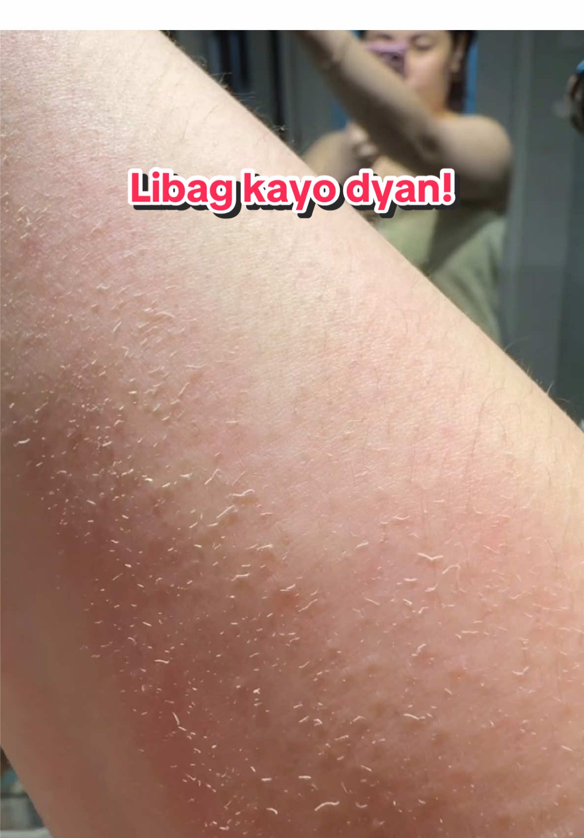 Dewy alada para sa glowing kutis!
